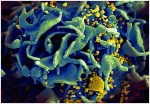 Science：新研究发现α4β7抗体在恒河猴SIVmac251感染模型中并不提供治疗功效