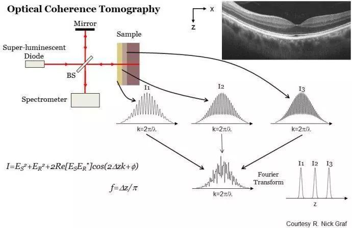 解读光学相干层析(OCT)成像技术